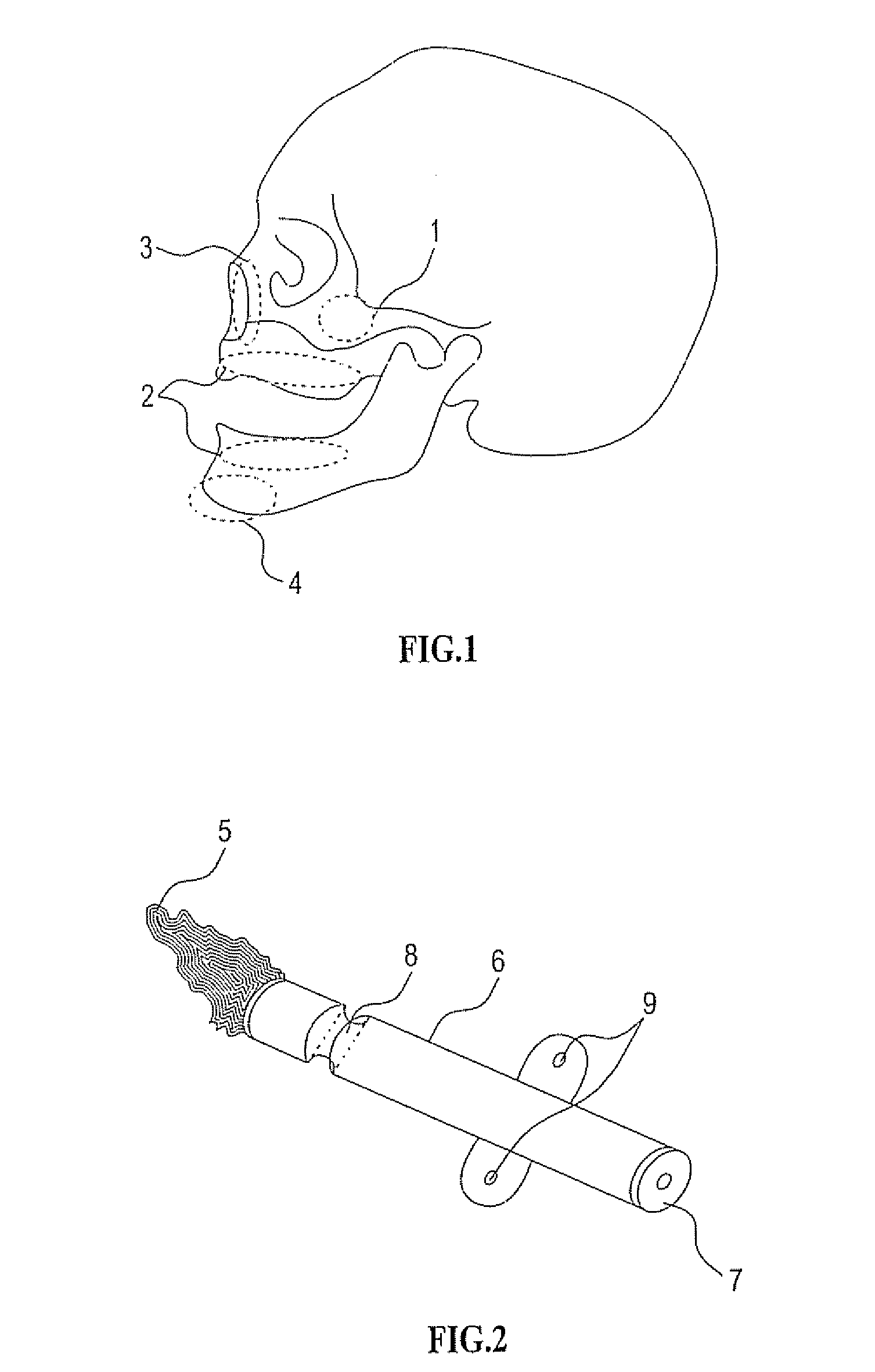 Bioresorbable Inflatable Devices, Incision Tool And Method For Tissue Expansion And Tissue Regeneration