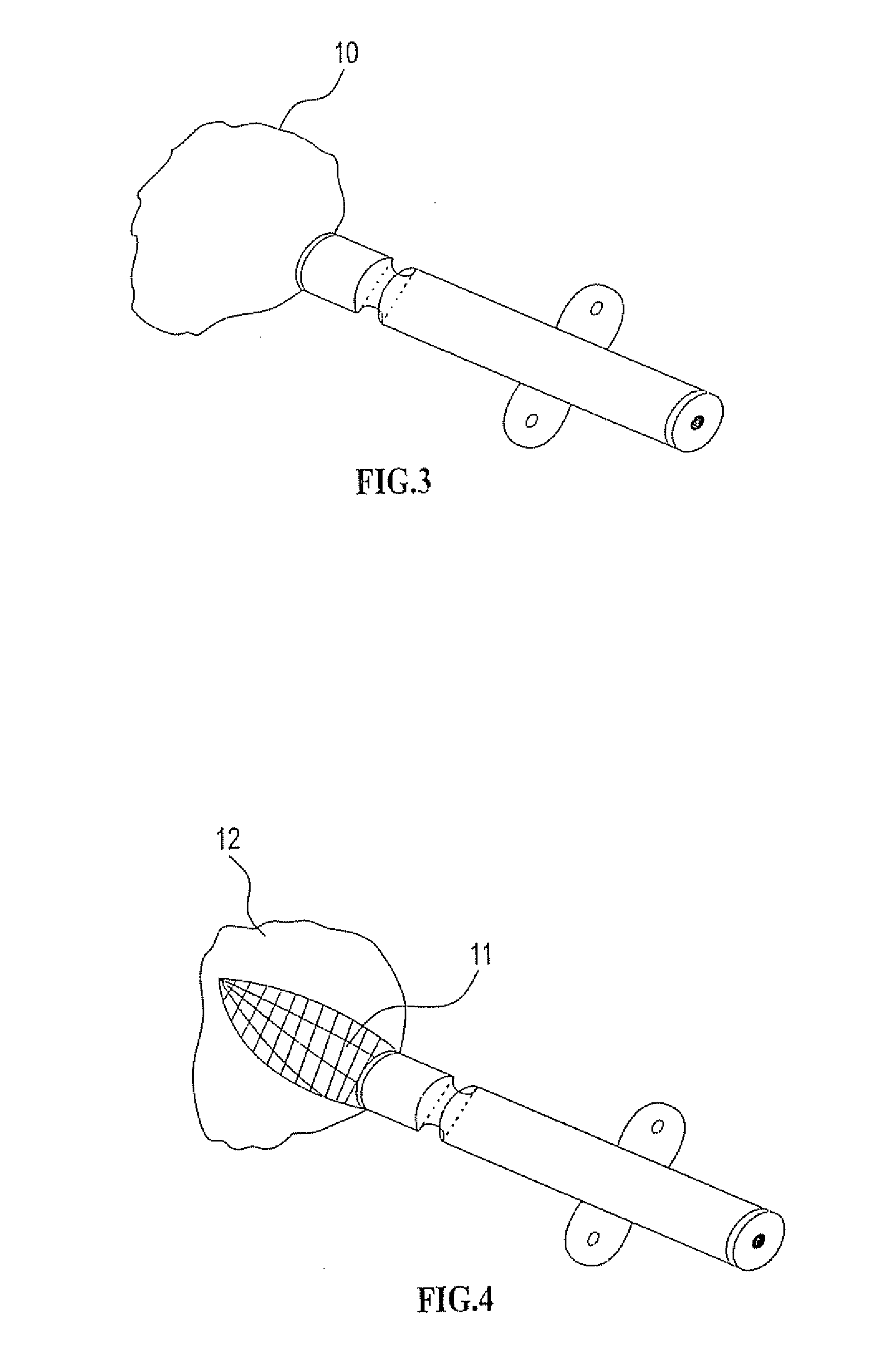 Bioresorbable Inflatable Devices, Incision Tool And Method For Tissue Expansion And Tissue Regeneration