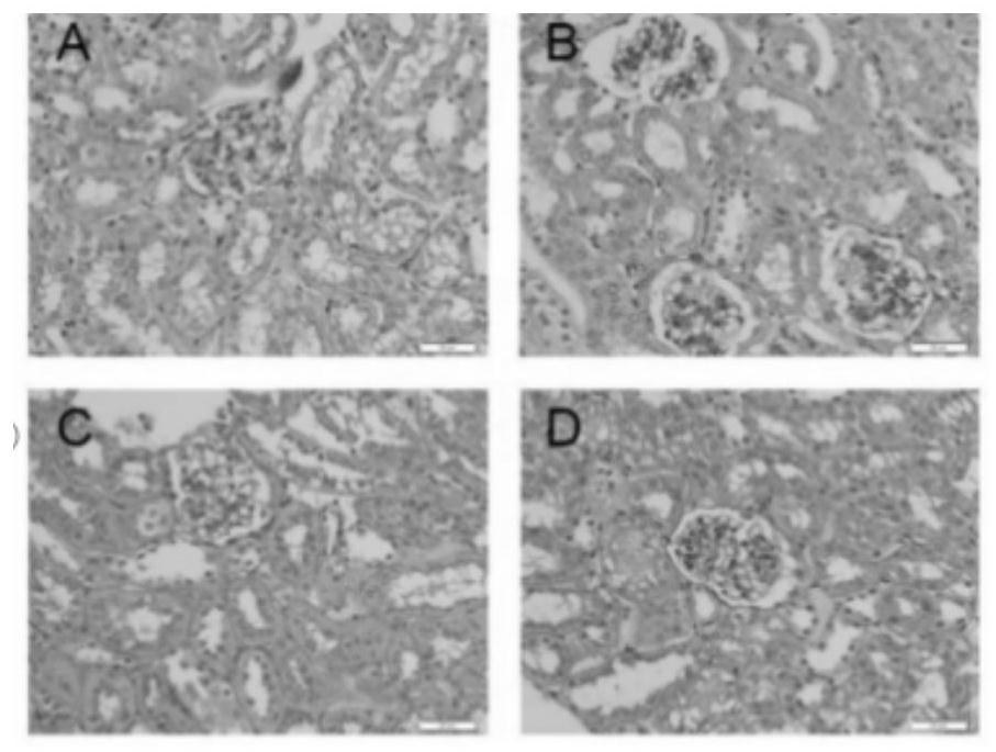 A traditional Chinese medicine composition for treating diabetic nephropathy and its preparation method