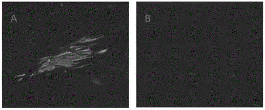 Recombinant turkey herpesvirus vaccine expressing infectious bursal disease virus VP2 protein and application thereof