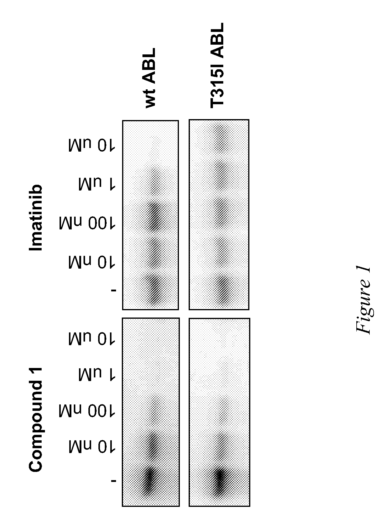 Use of a kinase inhibitor for the treatment of particular resistant tumors