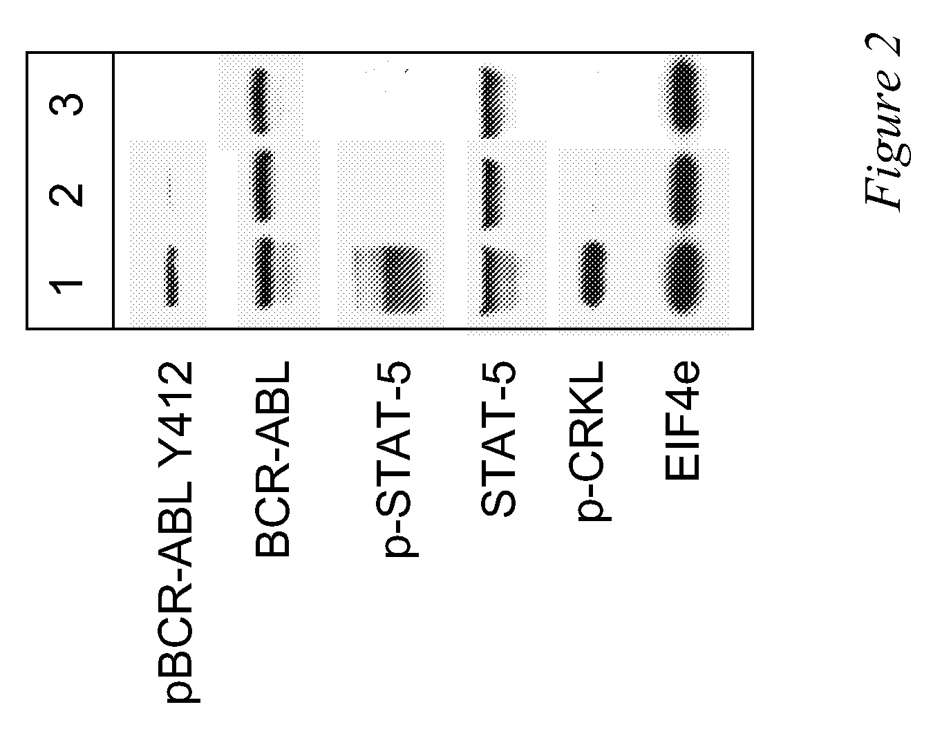 Use of a kinase inhibitor for the treatment of particular resistant tumors