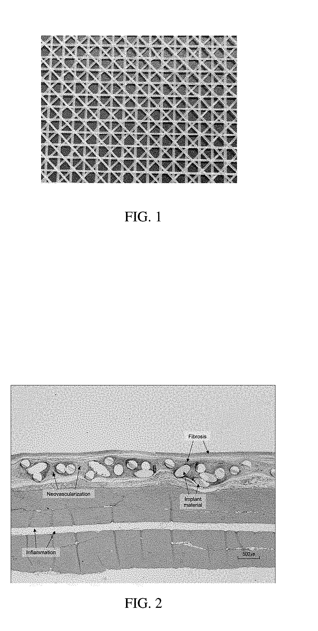 Oriented implants containing poly(butylene succinate) and copolymer, and methods of use thereof