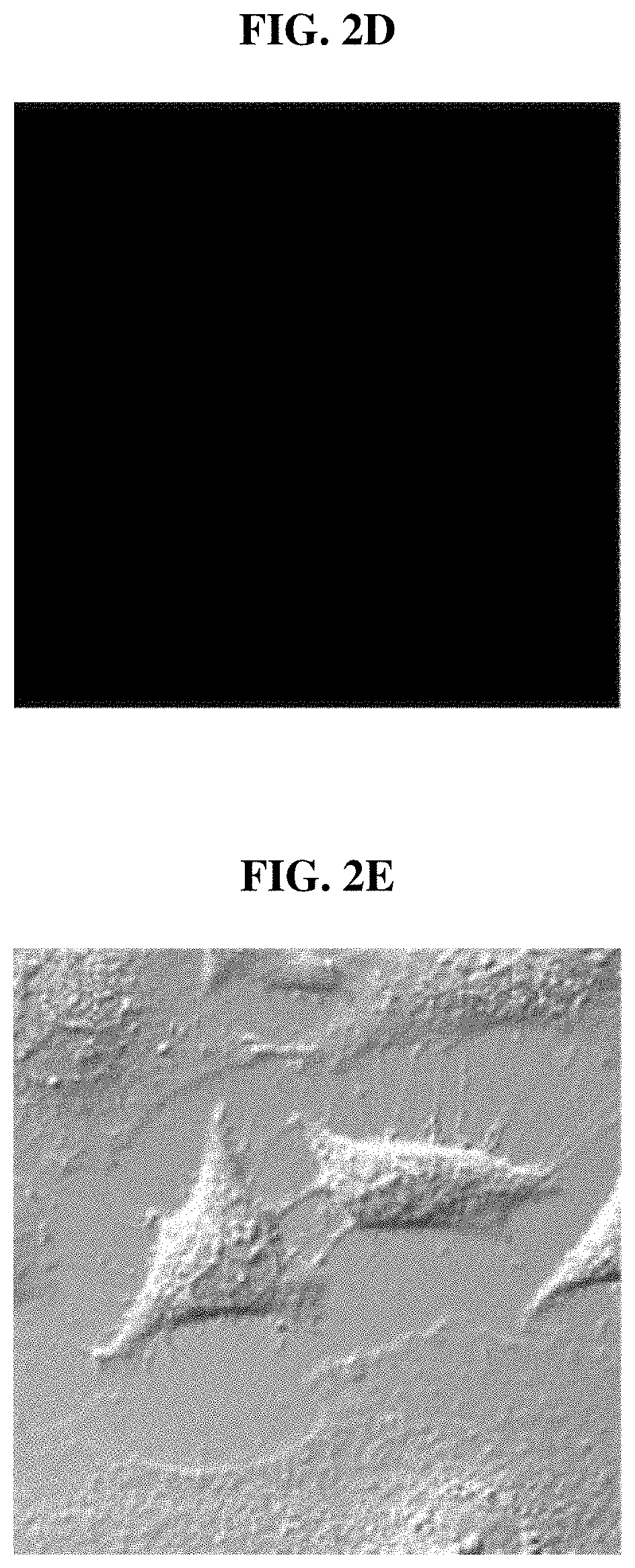 Pharmaceutical composition for preventing or treating degenerative brain disease