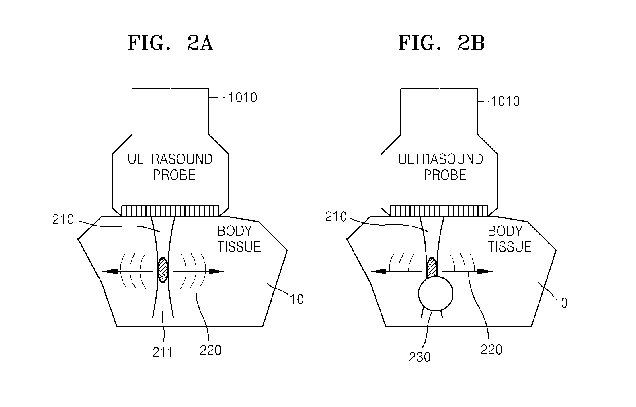 Method and ultrasound apparatus for providing ultrasound elastography image