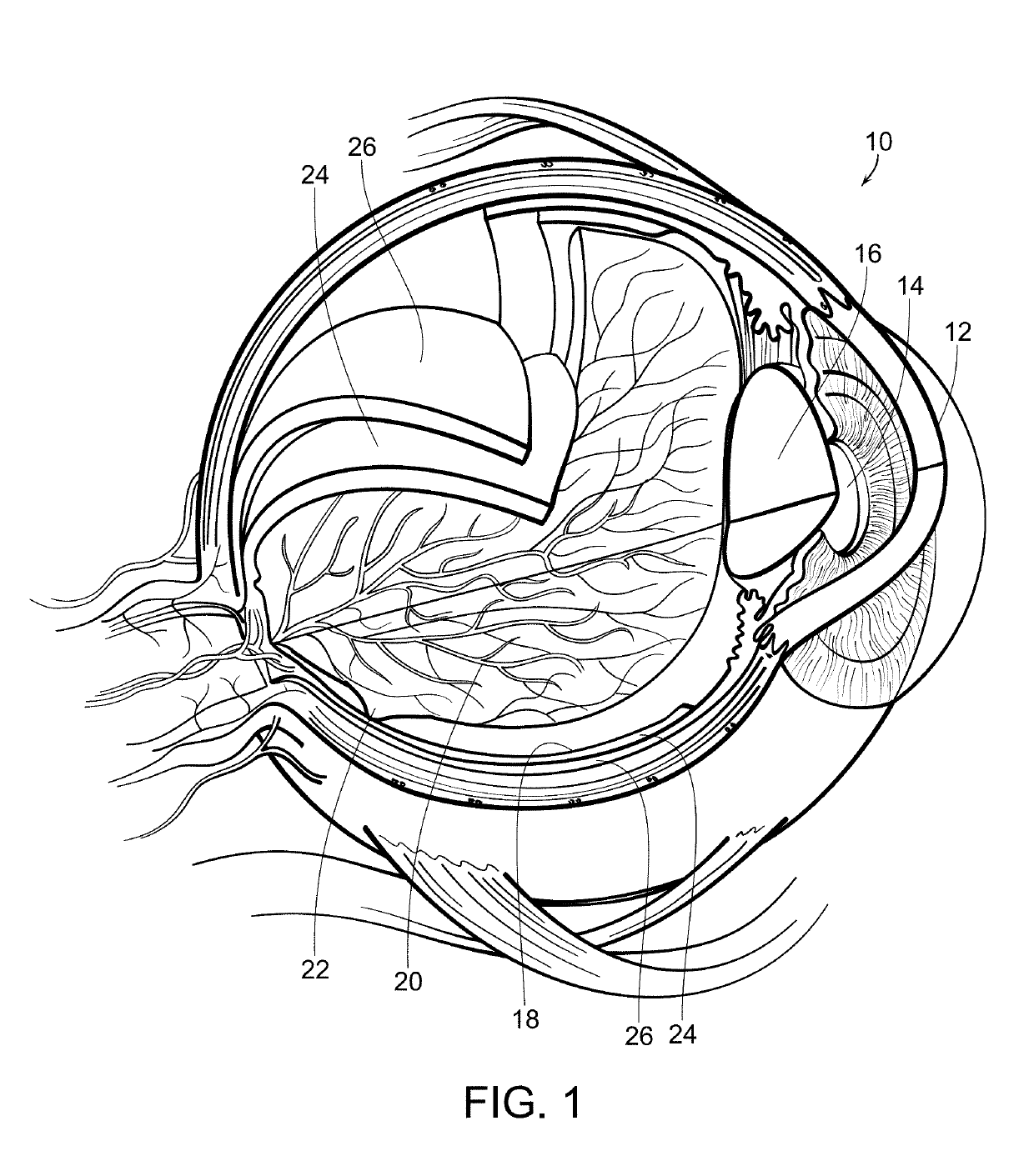 Process for adjusting treatment parameters for retina phototherapy based on rpe melanin levels