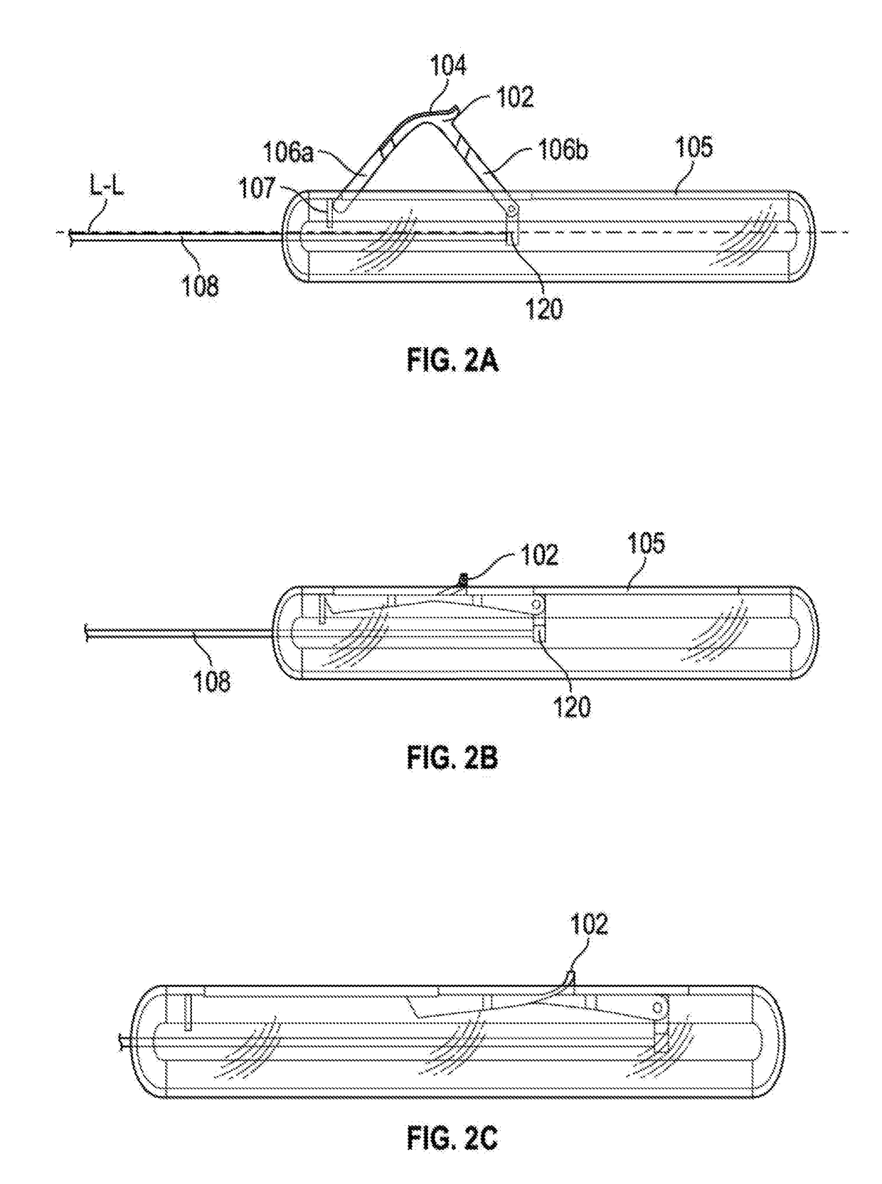 Stent delivery catheter with convertible living-hinge for slow to fast retraction