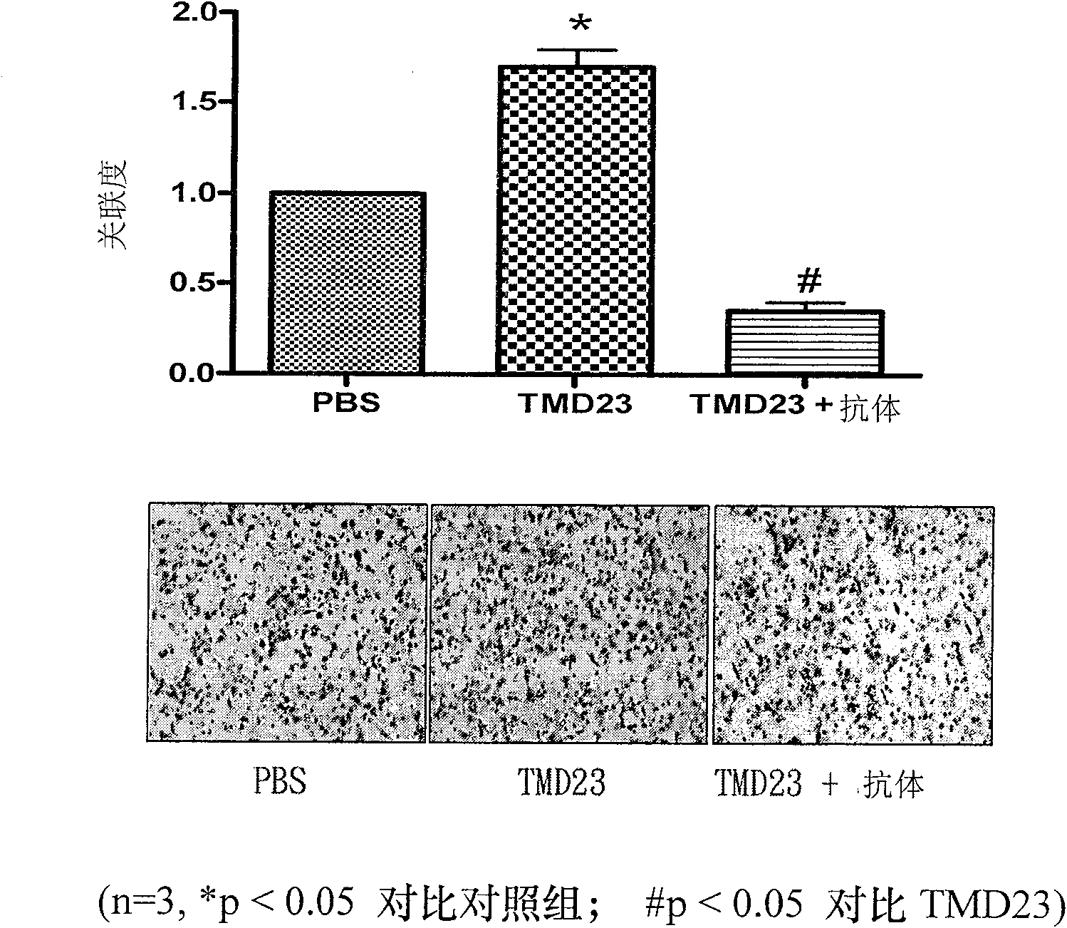 A composition for wound healing and use thereof