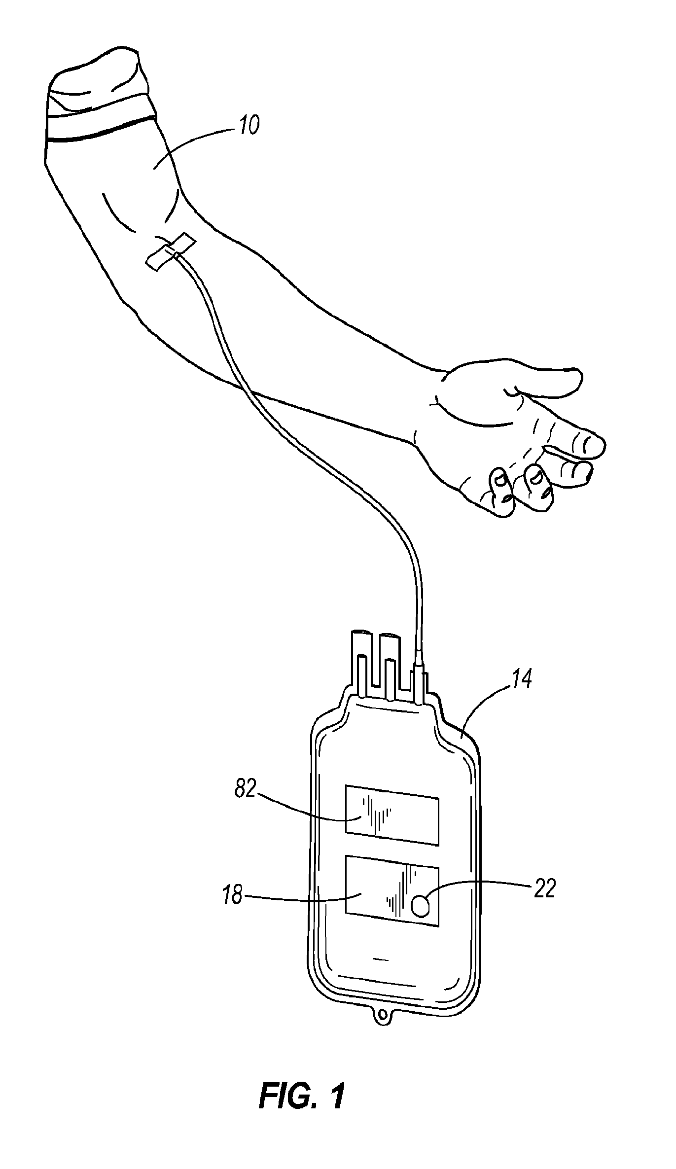 Method and apparatus for identifying and tracking biological fluid