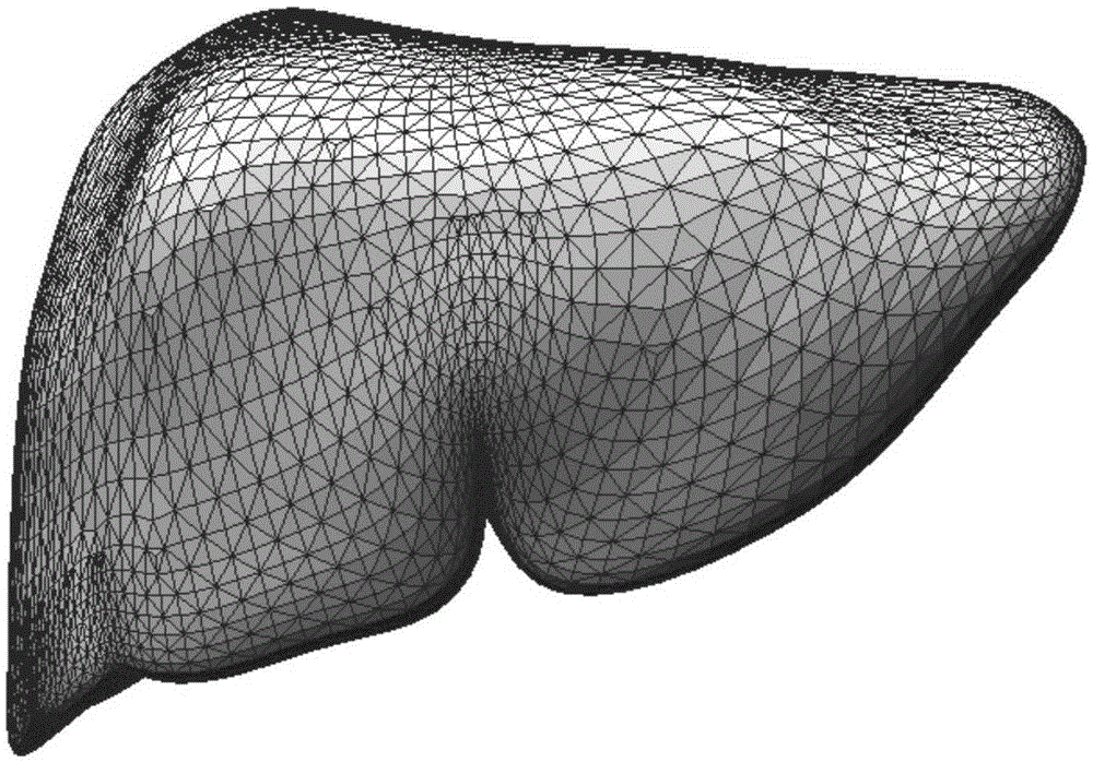 GPU-based automatic generation and collision detection method for soft tissue organ metaball model