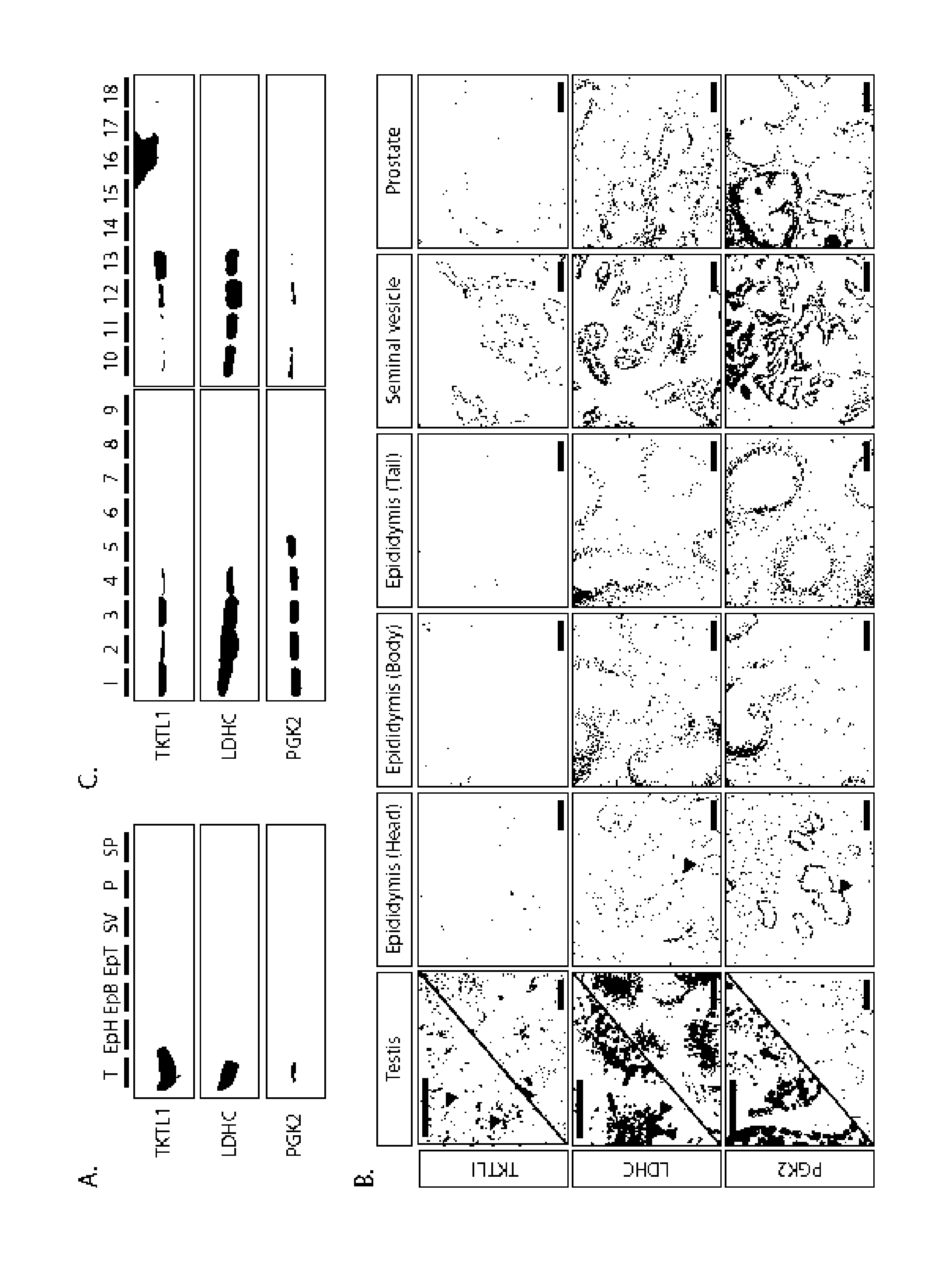 Method for predicting the presence of reproductive cells in TESTIS