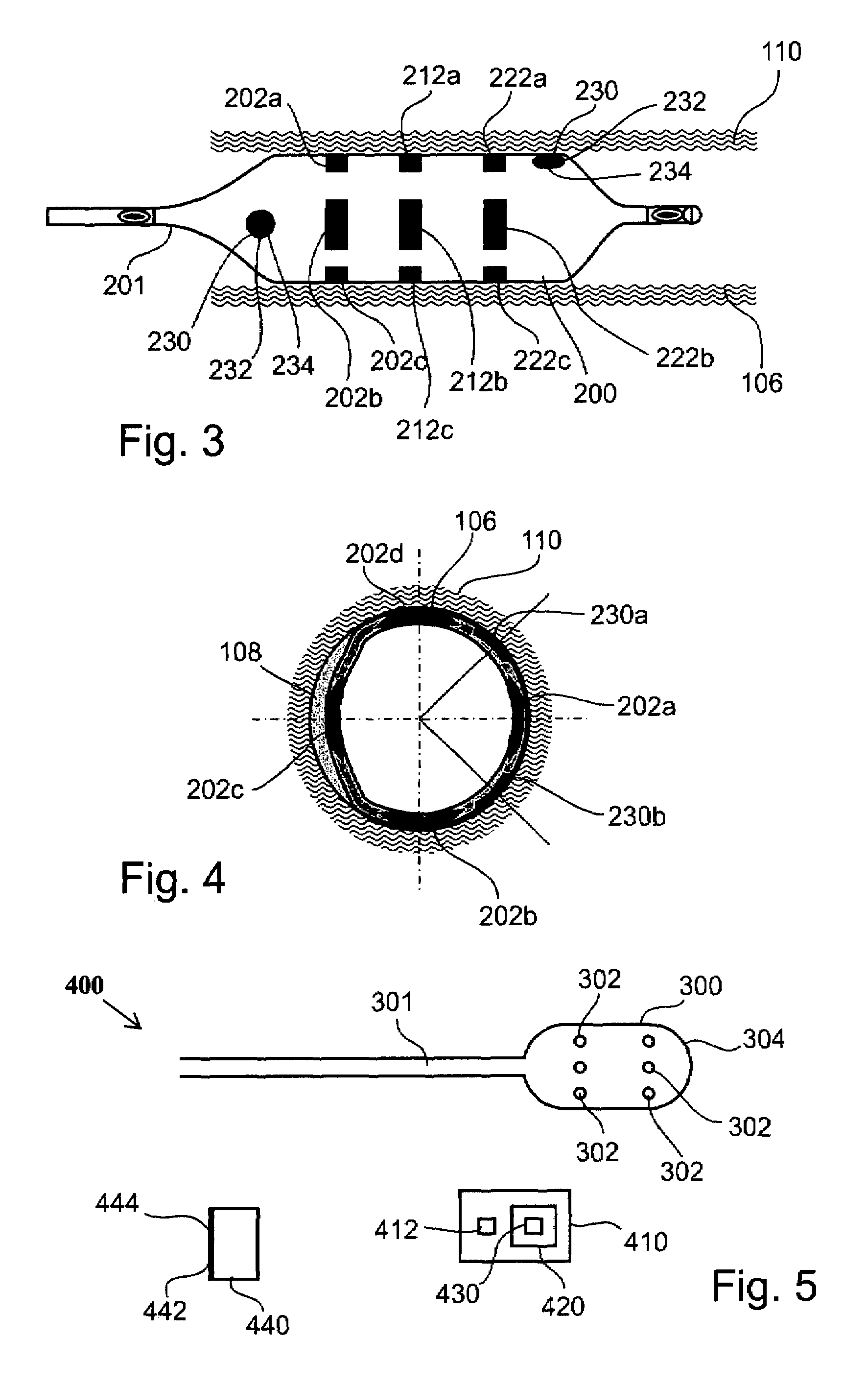 Device, system, and method for detecting and localizing obstruction within a blood vessel