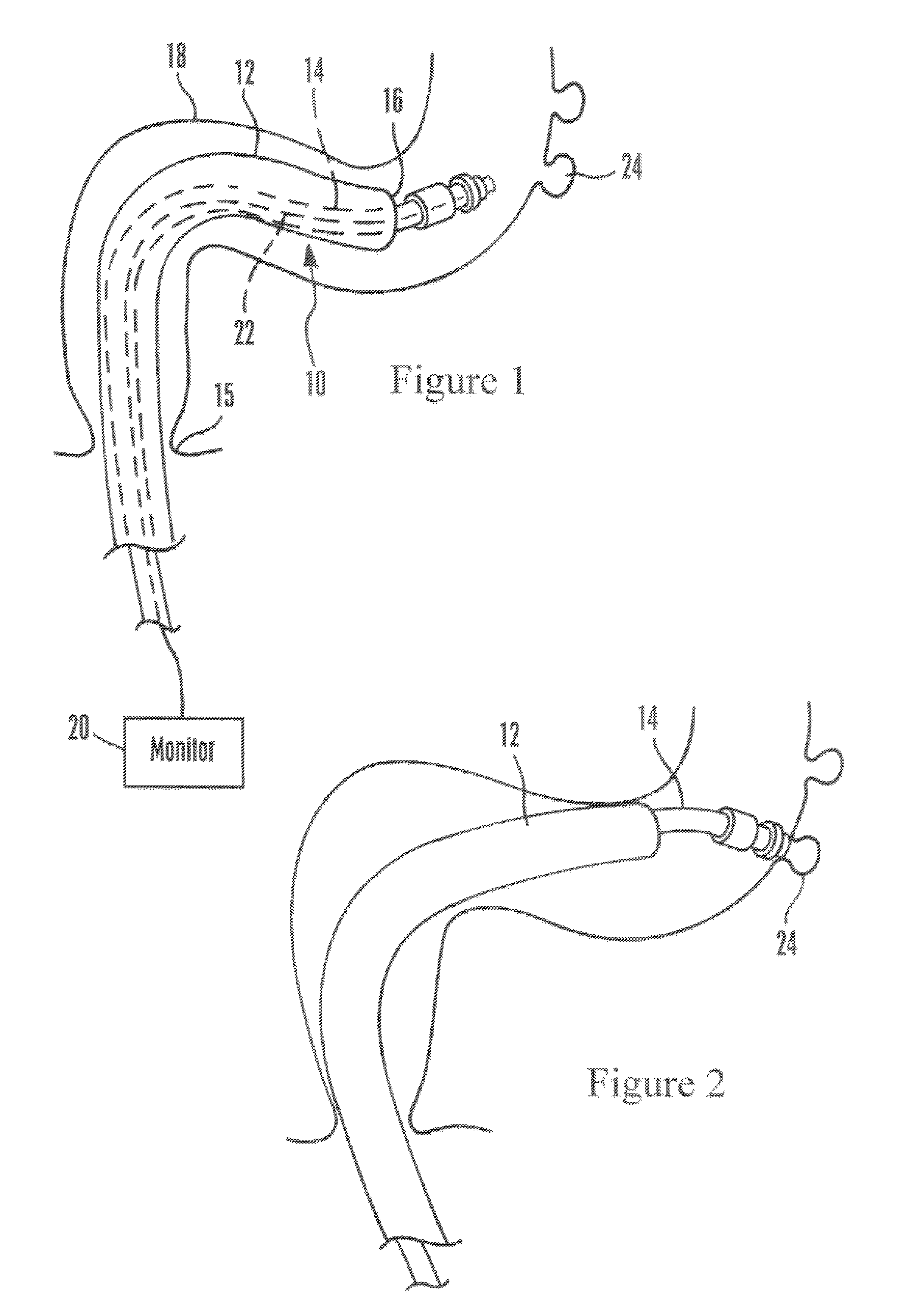 Devices and methods for securing tissue