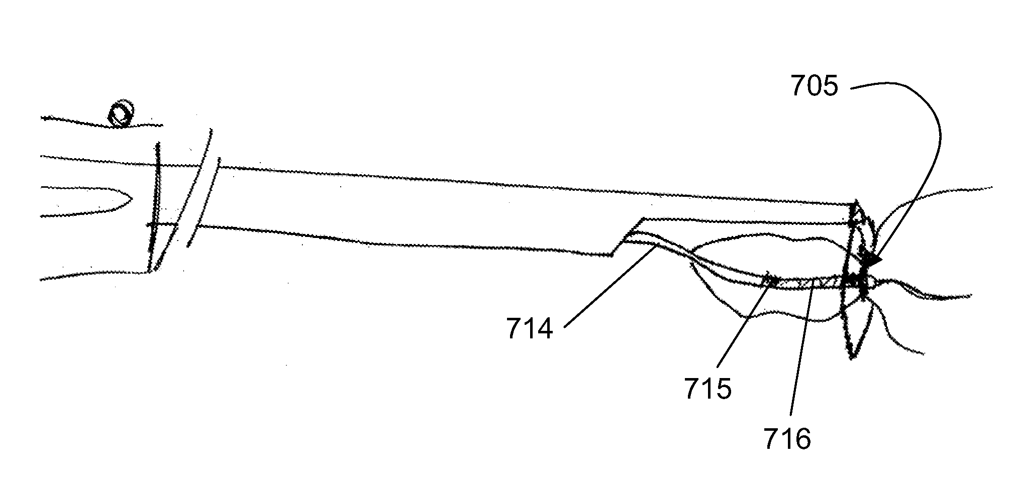 Methods and devices for accessing and delivering devices to a heart