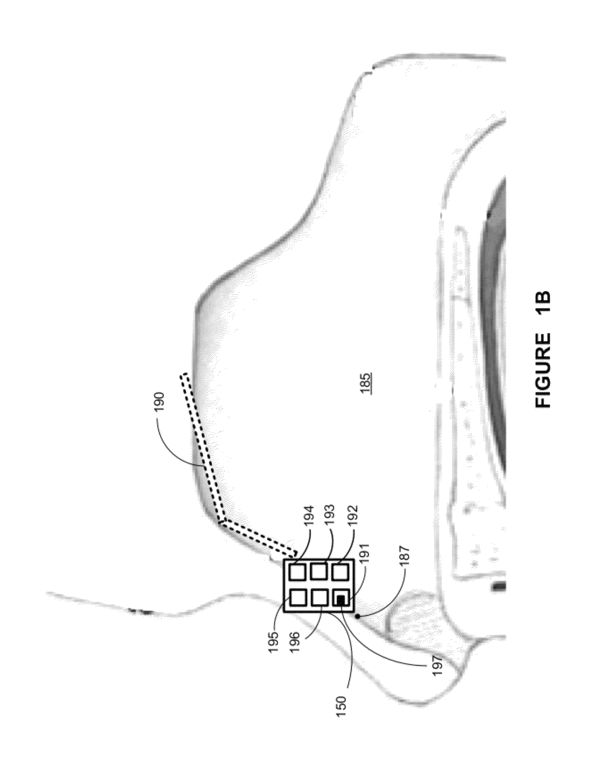 Apparatus and methods for delivery of therapeutic agents to mucous or serous membrane