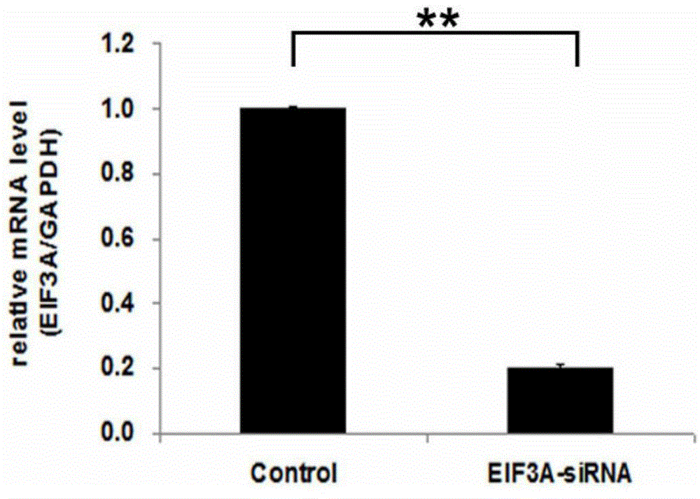 Application of human EIF3A gene and related drugs