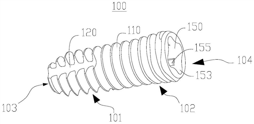 Implants and implant systems