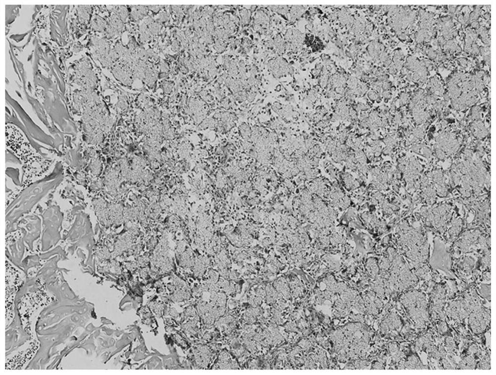 Preparation method and application of controllable degradation tissue reconstruction and repair material