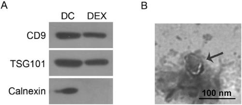 Fusion protein, cell exosome and tumor vaccine, and application thereof