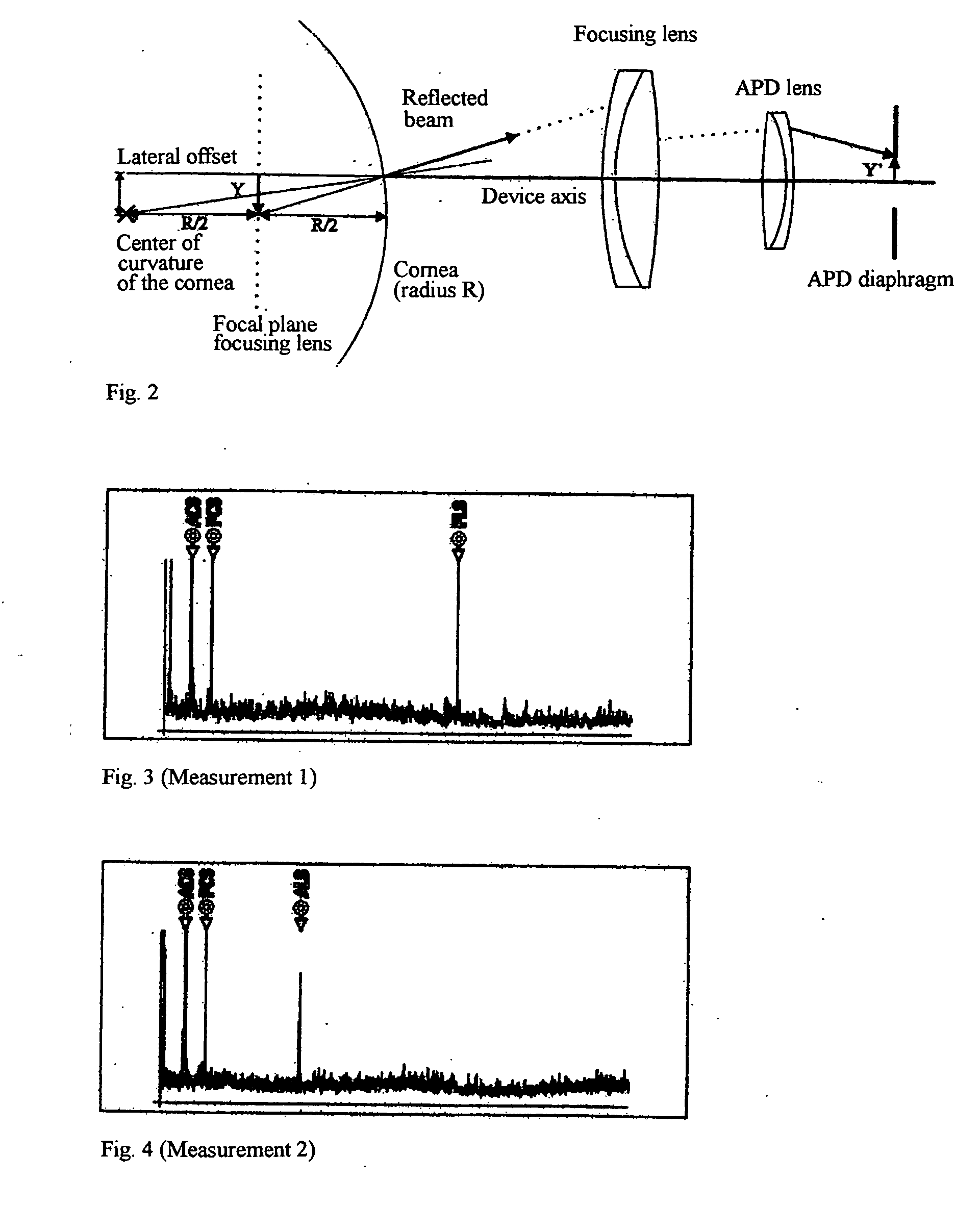 Method and arrangement for the measurement of the anterior segment of the eye