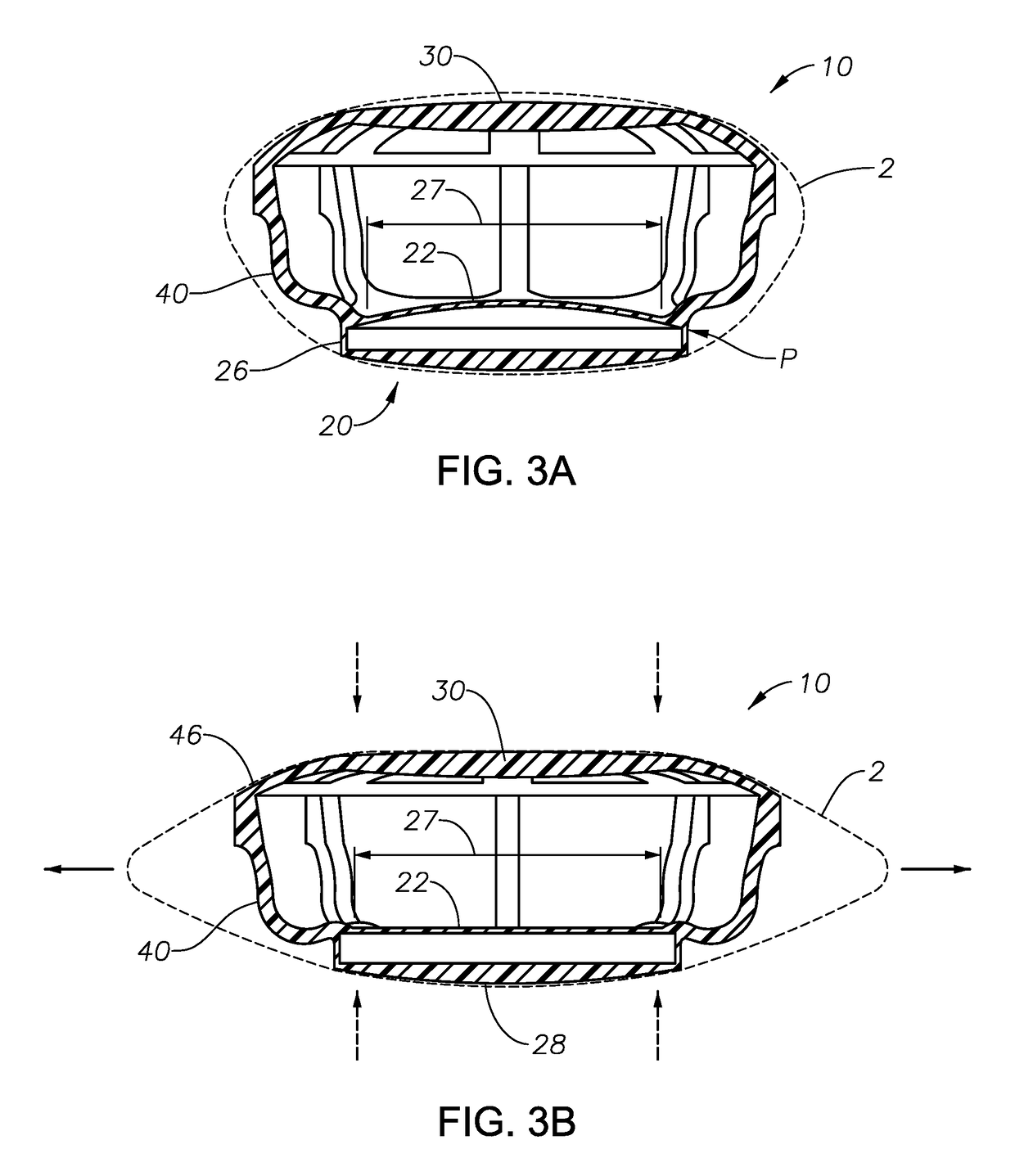 Dual optic, curvature changing accommodative IOL having a fixed disaccommodated refractive state