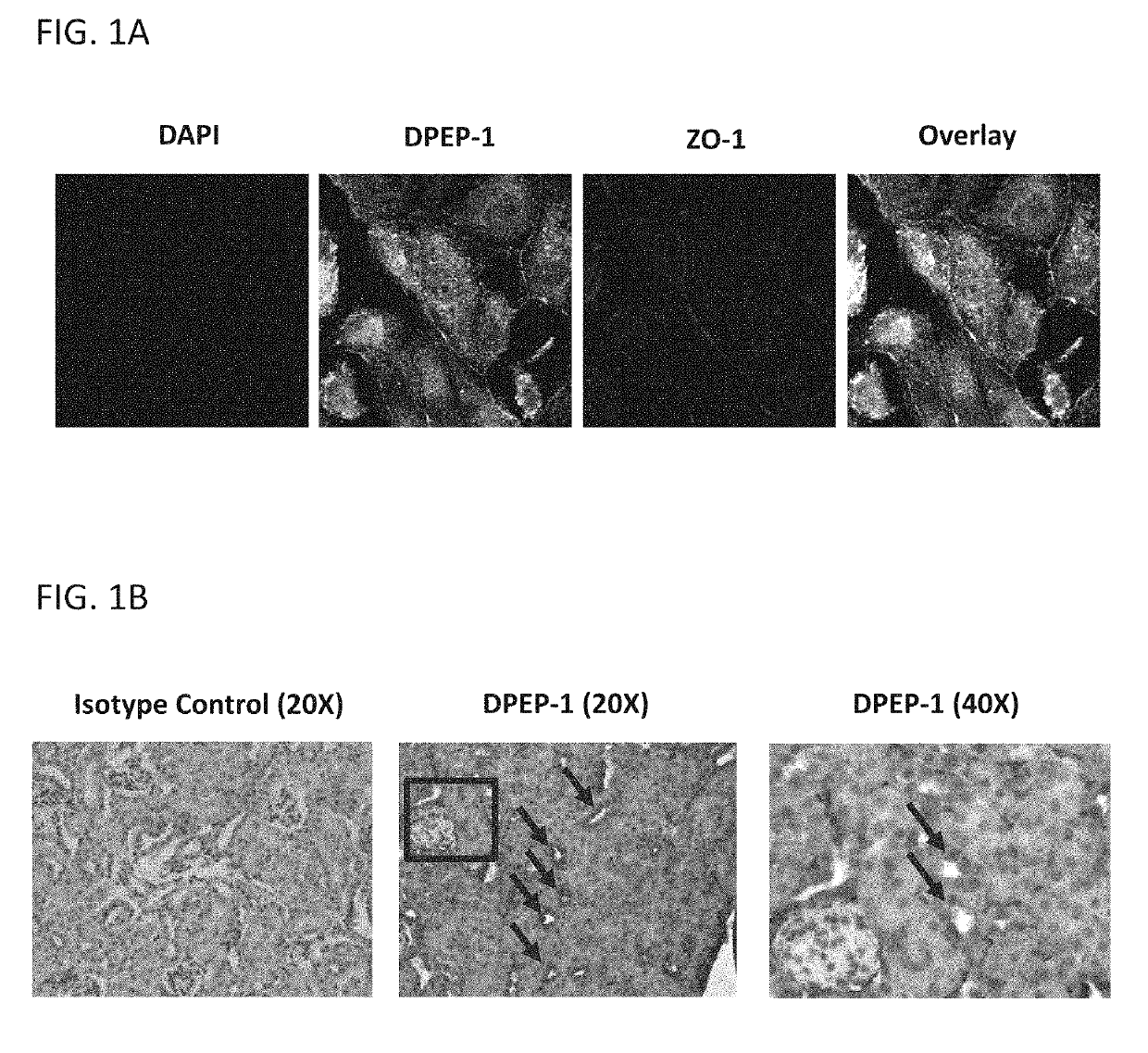 DPEP-1 binding compositions and methods of use