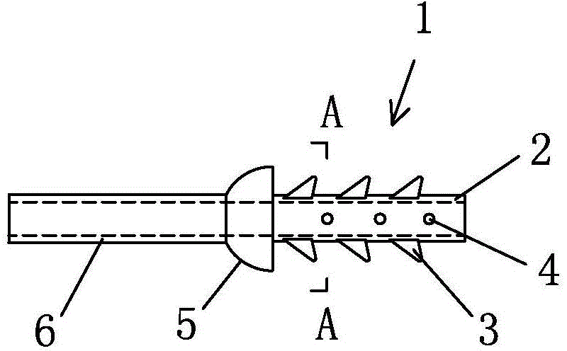 3D (three-dimensional) printed stitch-free pancreatico-duodenectomy stent and manufacturing method thereof