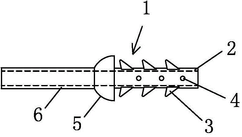 3D (three-dimensional) printed stitch-free pancreatico-duodenectomy stent and manufacturing method thereof