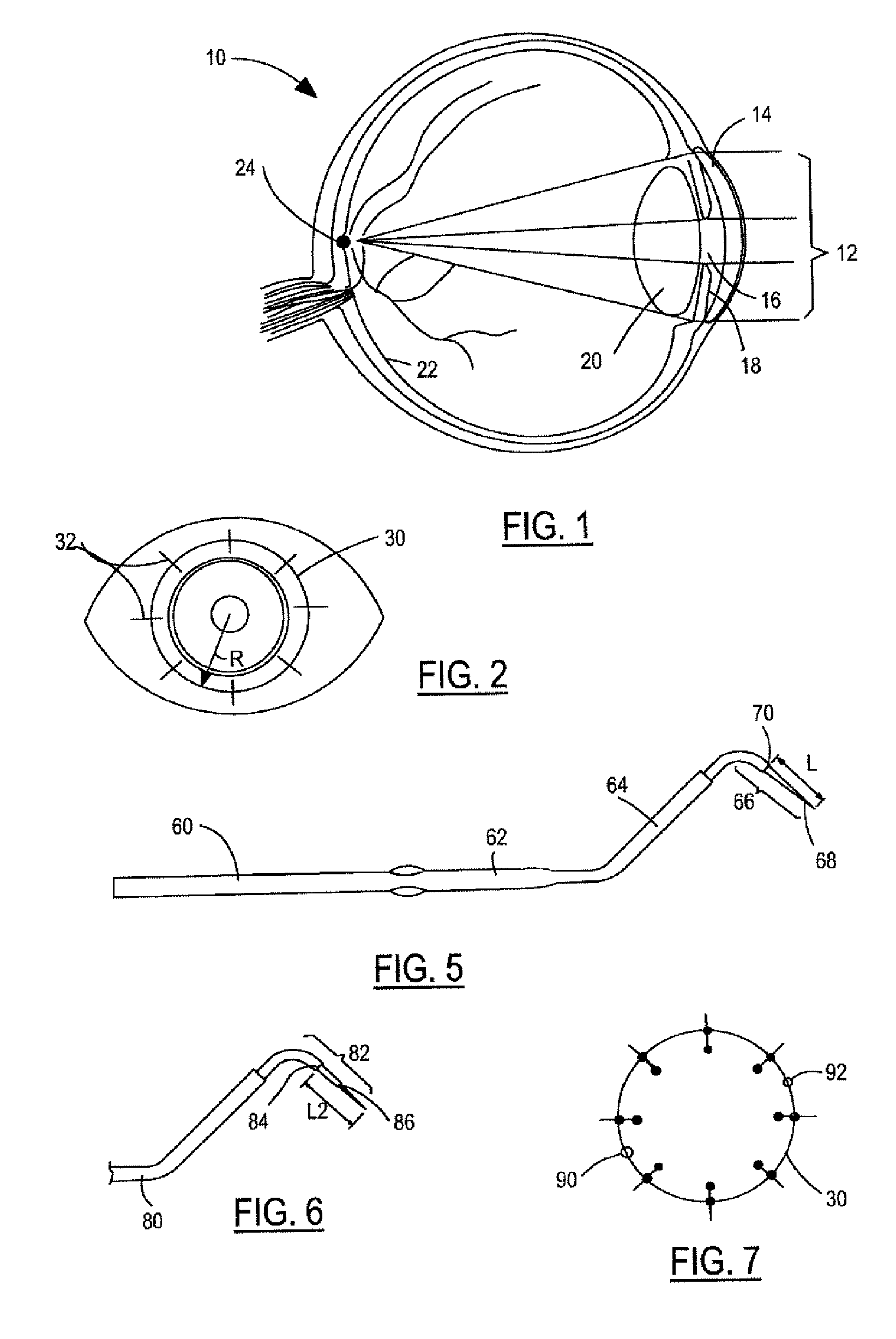 Instrument for conductive keratoplasty