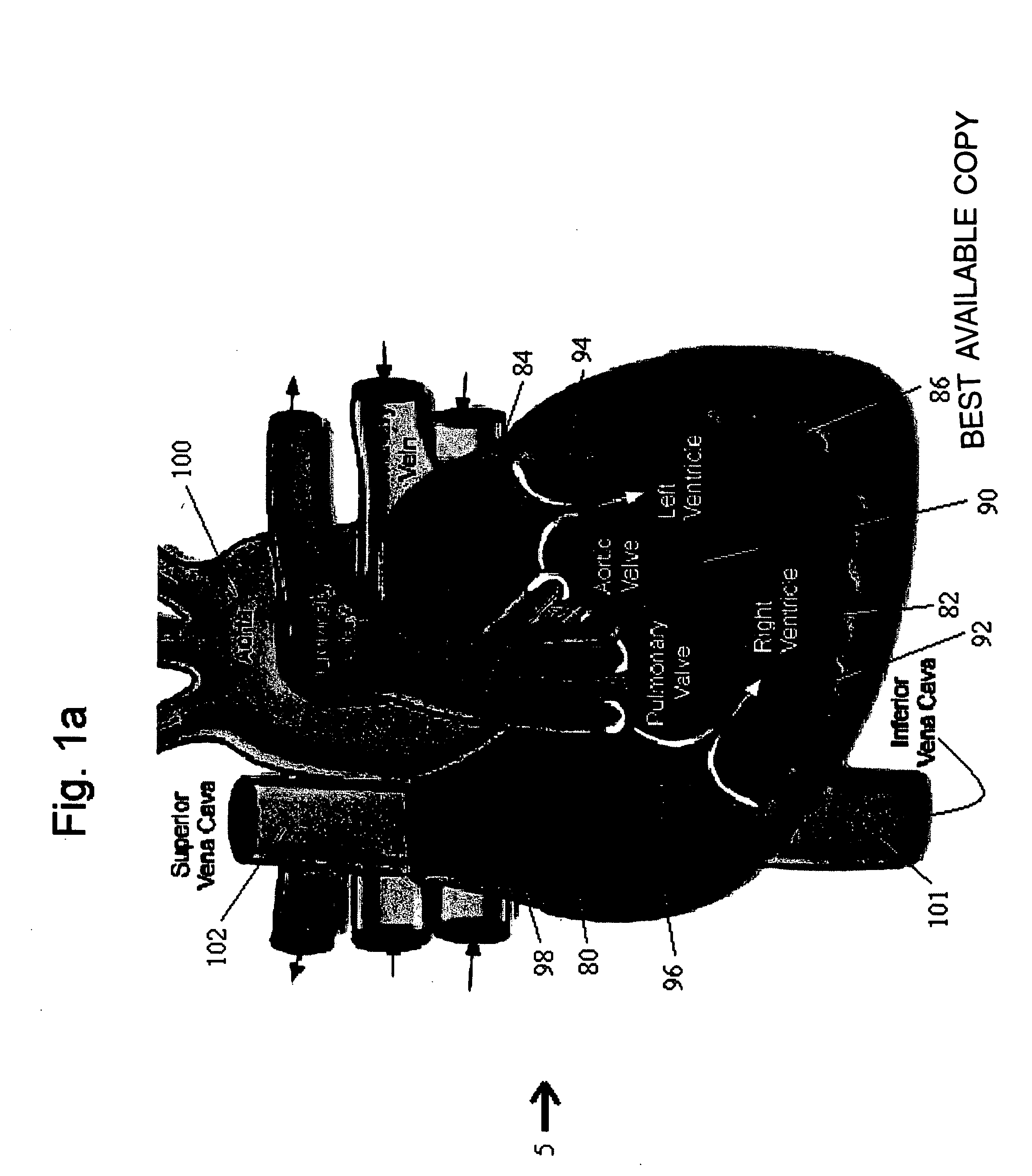 Methods and implantable devices for treating supraventricular arrhythmias