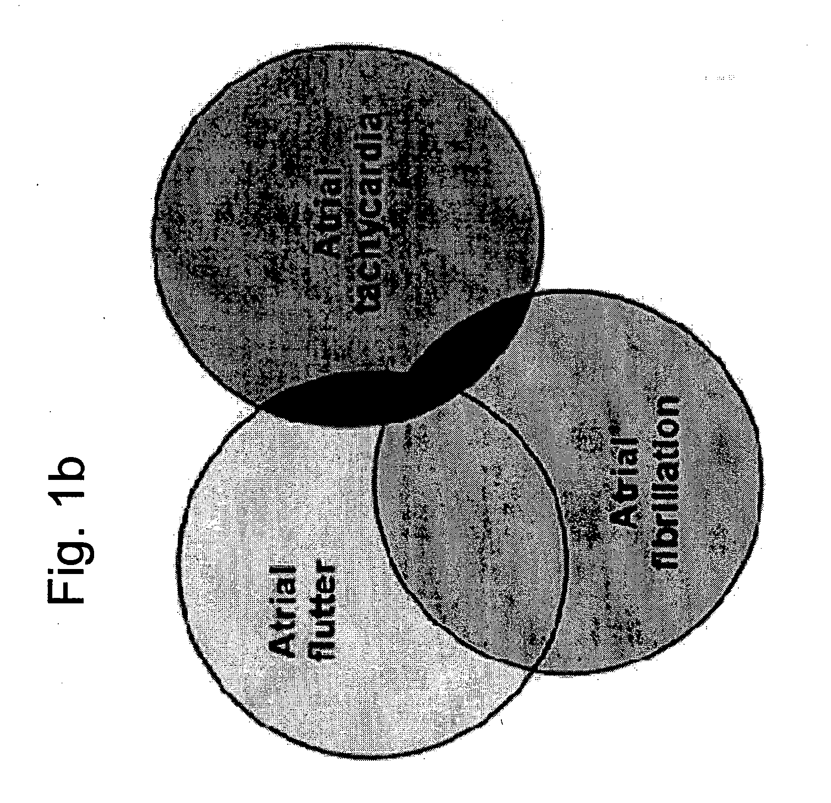 Methods and implantable devices for treating supraventricular arrhythmias