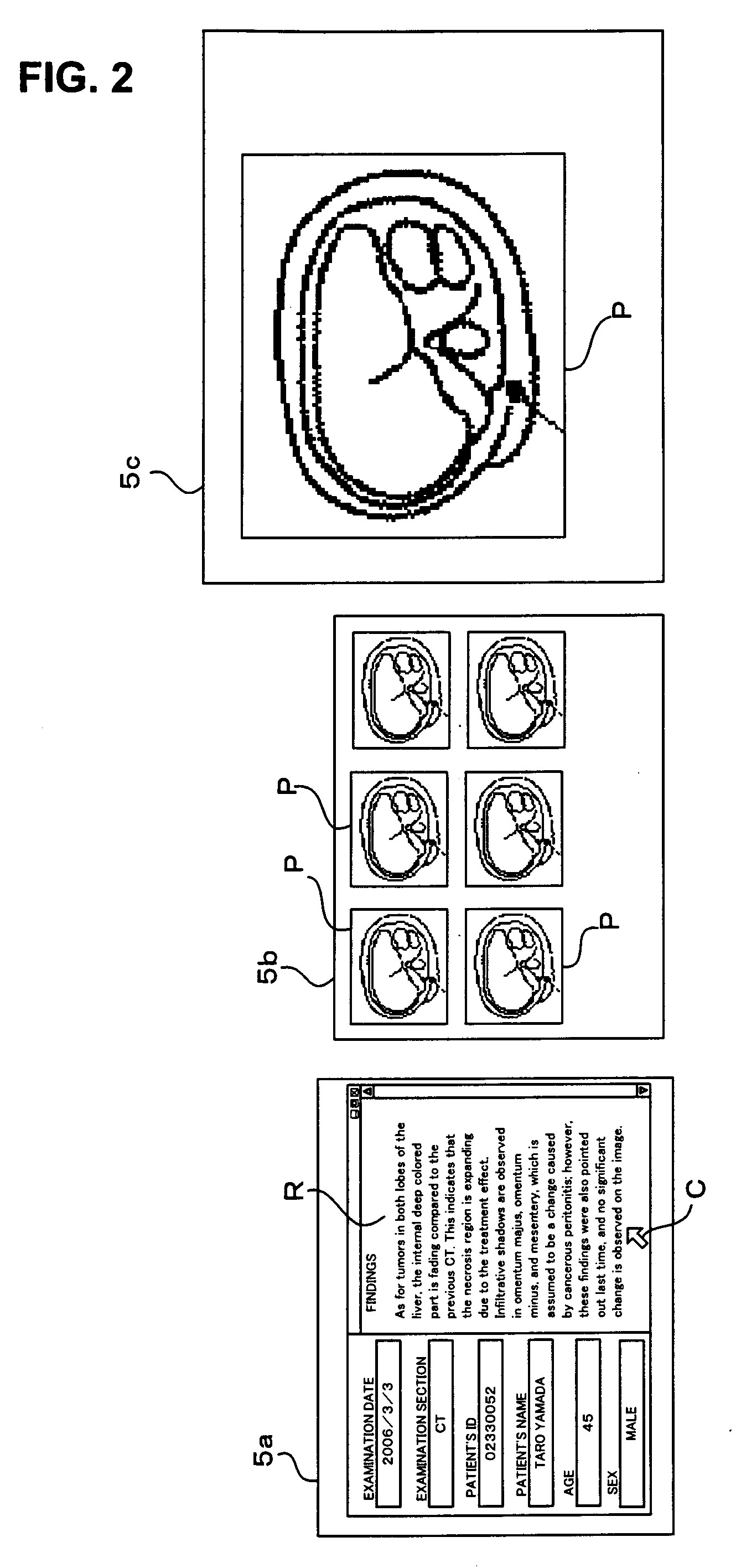 Medical image interpreting apparatus and cursor-moving method
