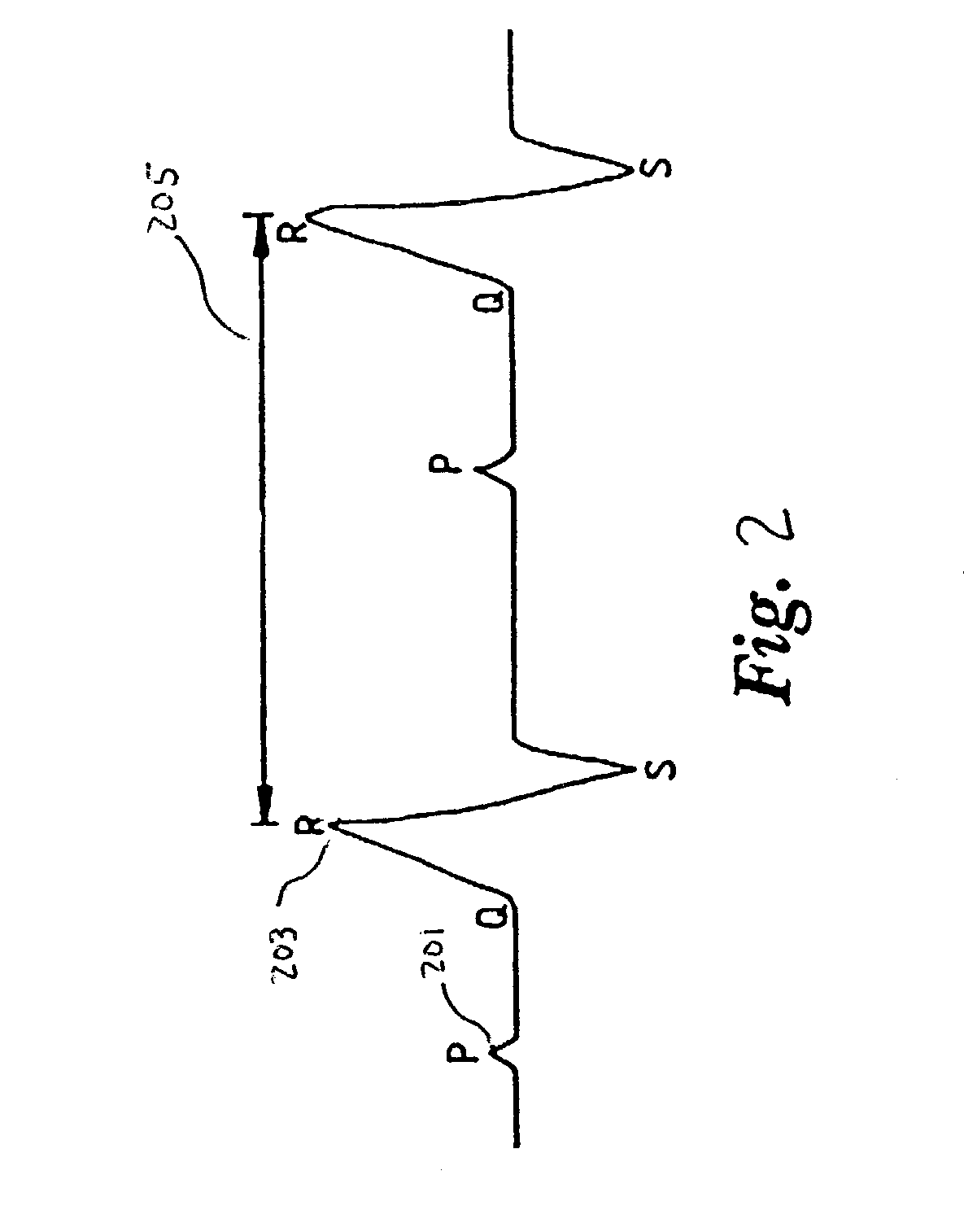 Method and apparatus for monitoring the autonomic nervous system using non-stationary spectral analysis of heart rate and respiratory activity