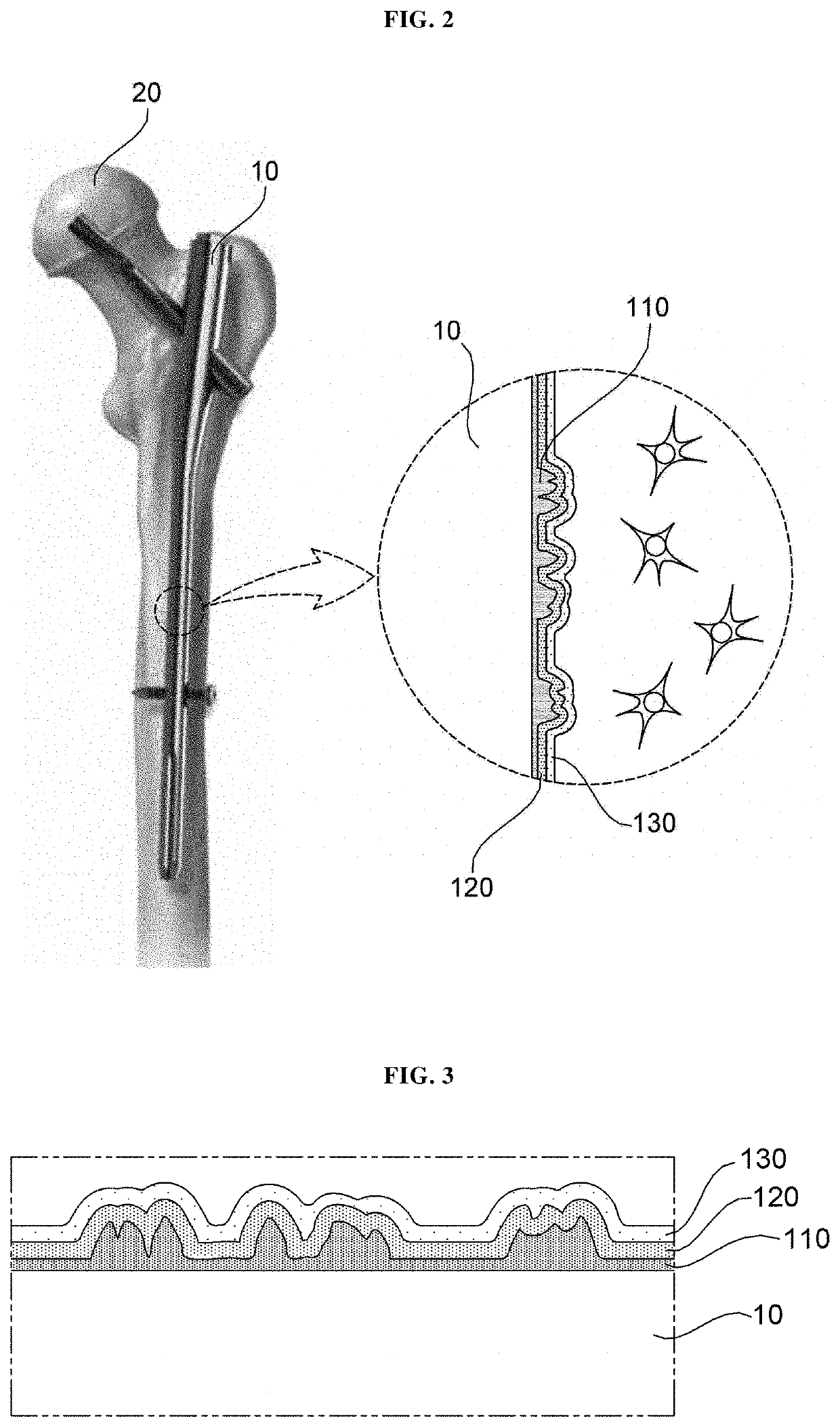 Surface coating structure of surgical prosthesis and method for modifying surface of surgical prosthesis using same