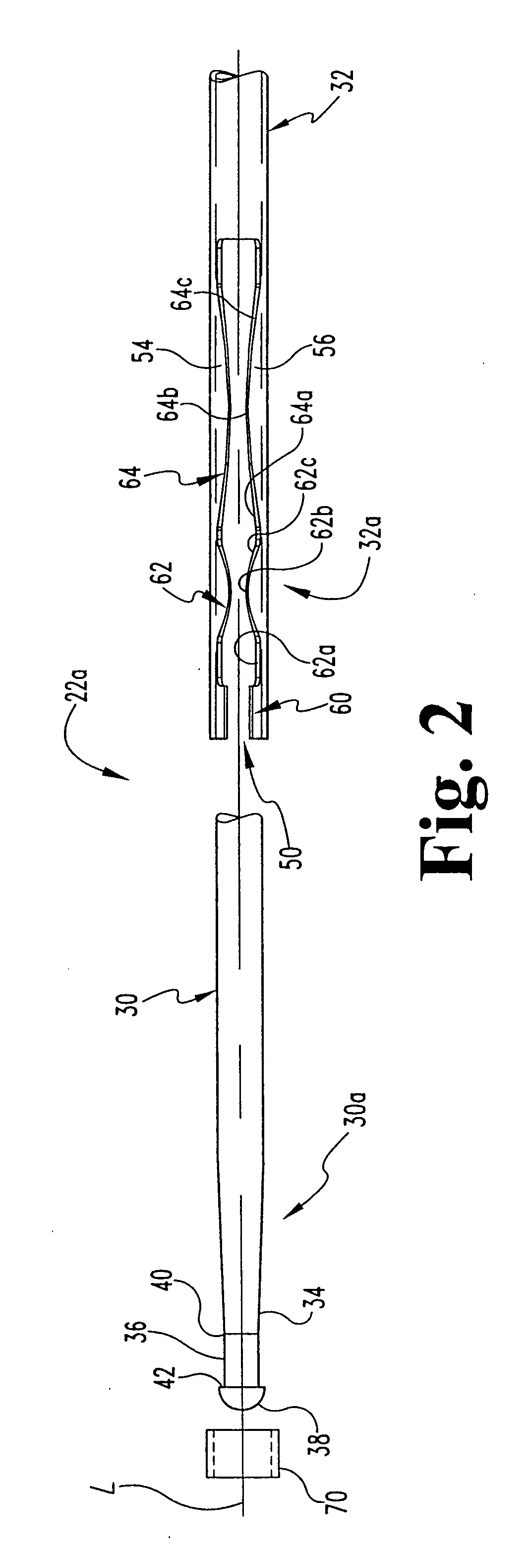 Surgical instrumentation and method for treatment of the spine