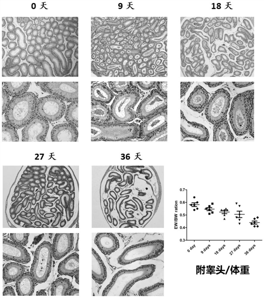 A kind of construction method of azoospermia mouse model