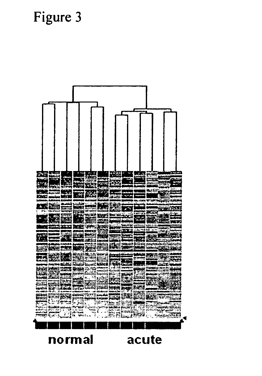 Methods and compositions for assessing acute rejection