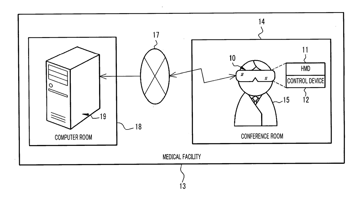 Control device of head mounted display, operation method and operation program thereof, and image display system