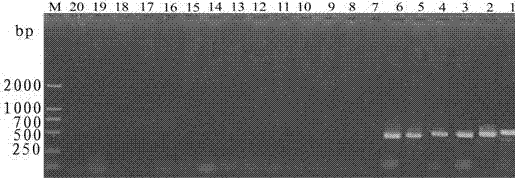 Molecular detection primer of acidovorax avenae and application thereof