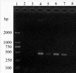 Molecular detection primer of acidovorax avenae and application thereof