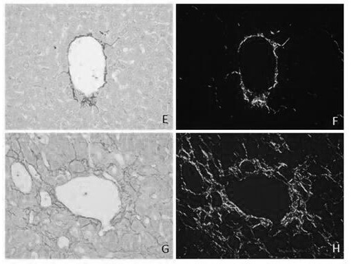 A staining method for observing collagen fibers by polarized light microscope