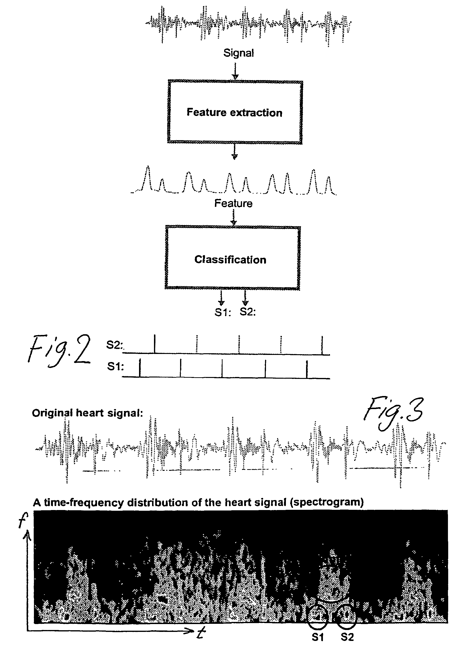 Procedure for extracting information from a heart sound signal