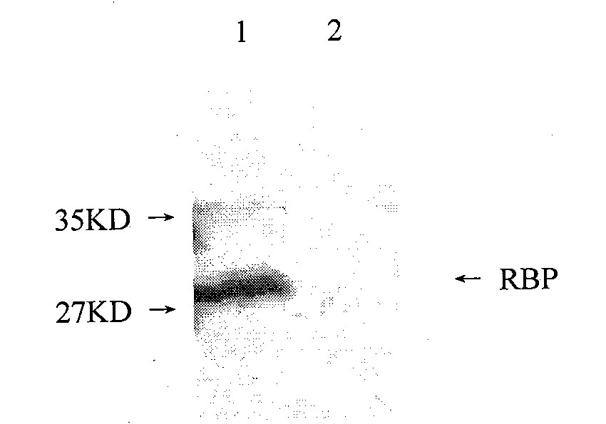 Rbp4 Hybridoma Cell Strain And Preparation Method And Application Thereof Eureka Patsnap 5233