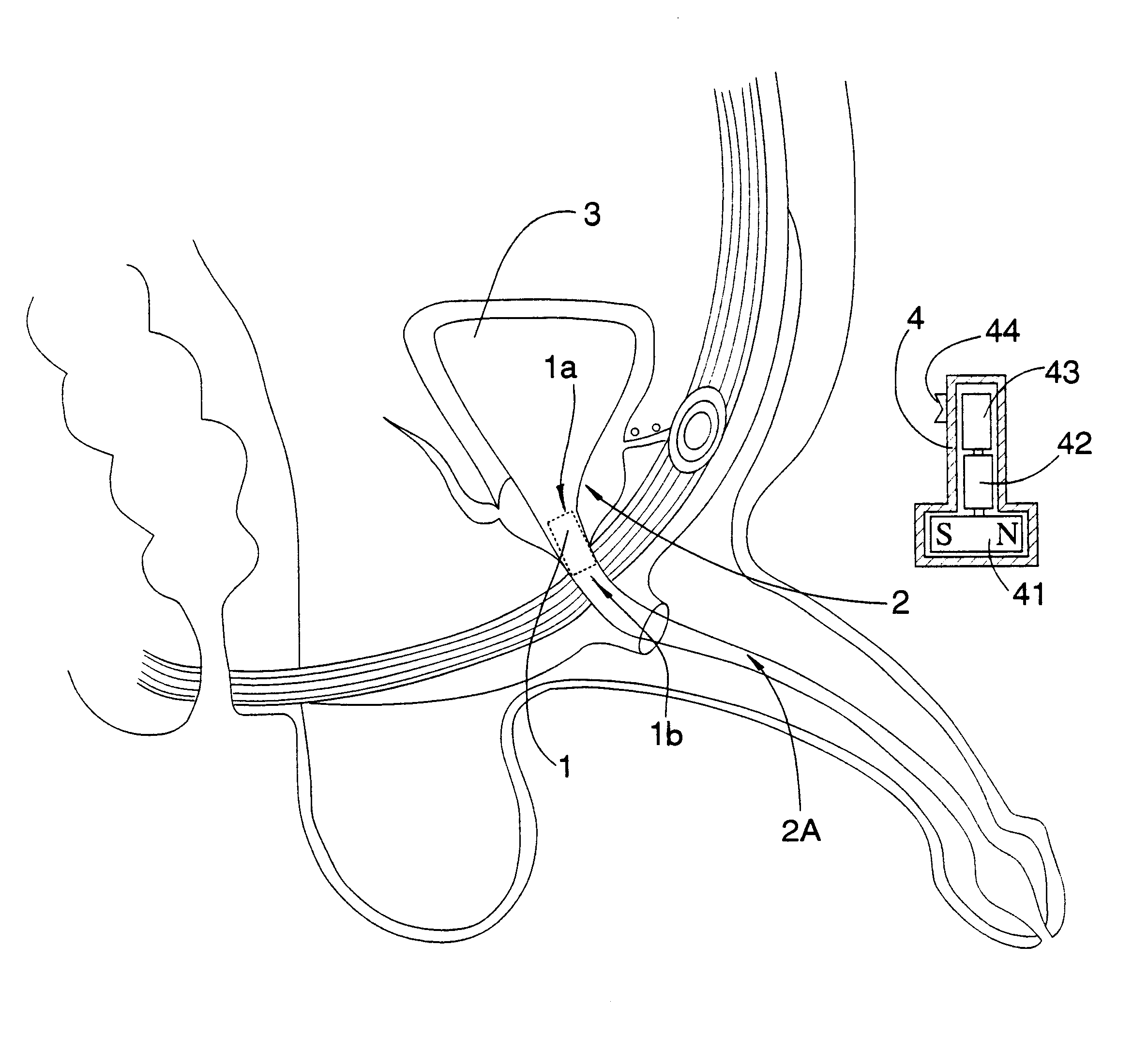 Magnetic actuation urethral valve
