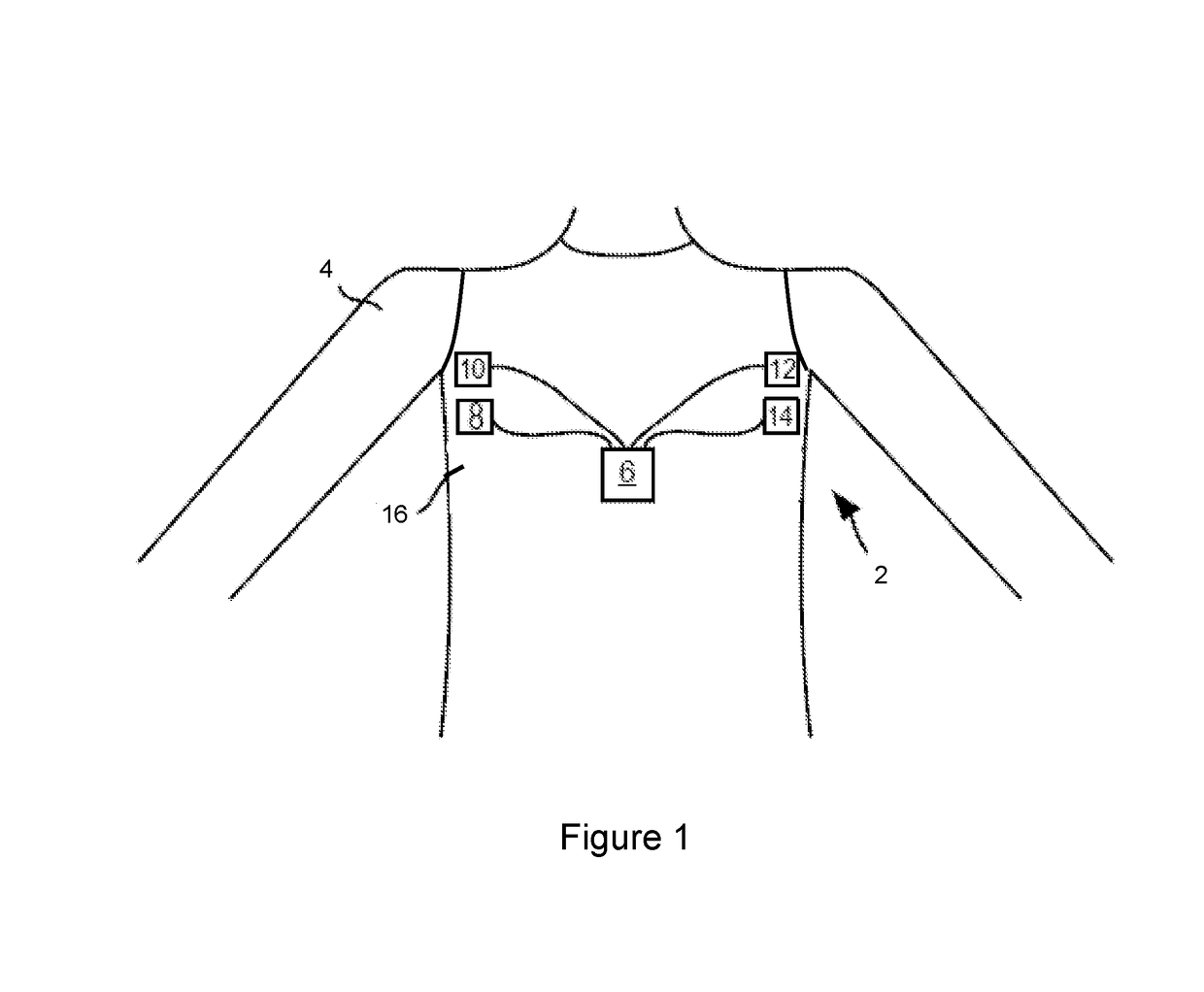 Method and apparatus for use in monitoring a physiological characteristic of a subject