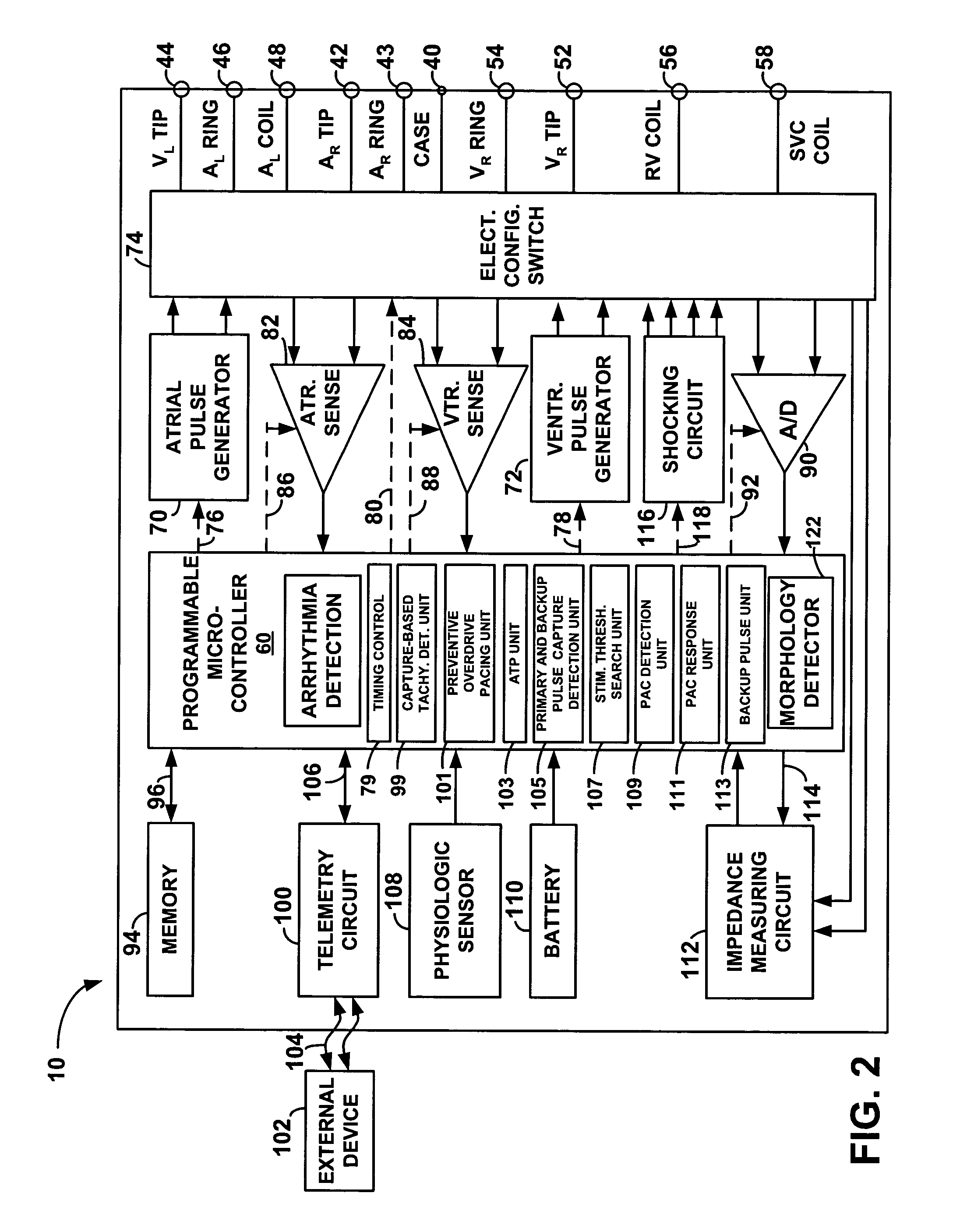 System and method for providing preventive overdrive pacing and antitachycardia pacing using an implantable cardiac stimulation device