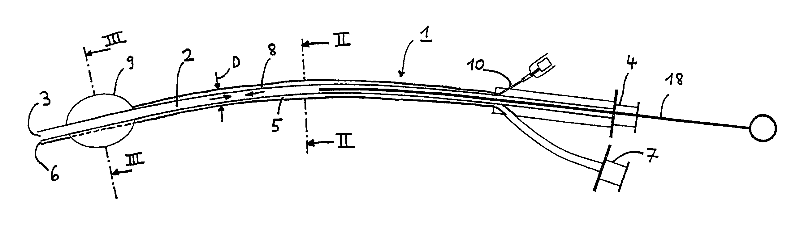 Jet ventilation catheter, in particular for ventilating a patient