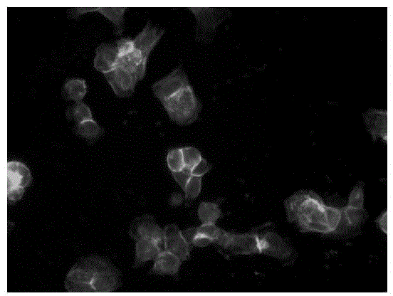 Application of toremifene citrate in preparation of medicines for inhibiting tumor cell metastasis and diffusion