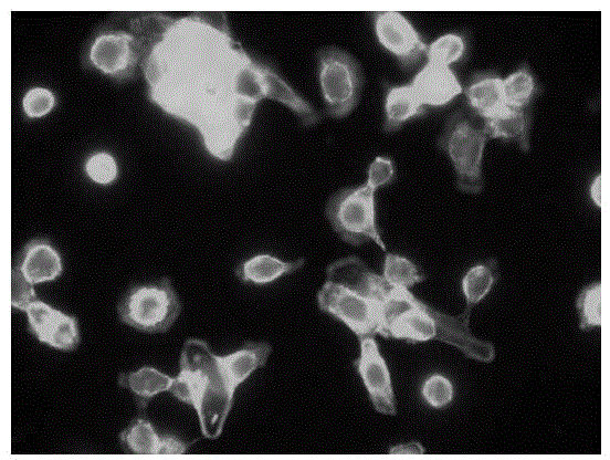 Application of toremifene citrate in preparation of medicines for inhibiting tumor cell metastasis and diffusion