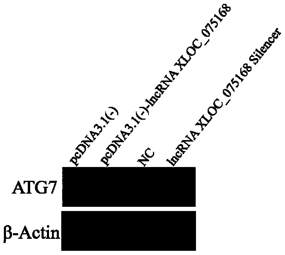 Application of LncRNA XLOC_075168 to preparation of medicines for promoting angiogenesis